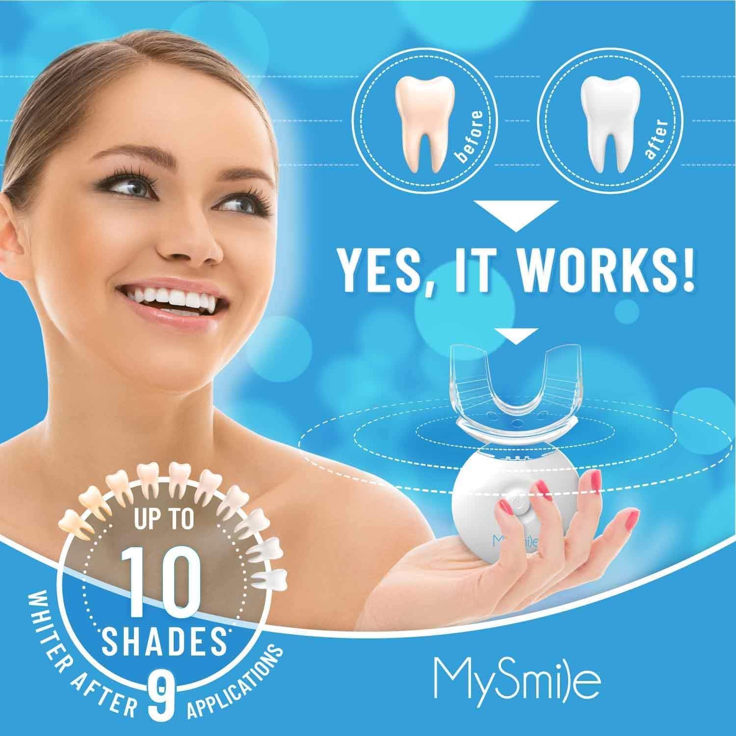Teeth Whitening Kit with LED Light, 10 Min Non-Sensitive Fast Teeth Whitener with 3 Carbamide Peroxide Whitening Gel, Helps to Remove Stains from Coffee, Smoking, Wines, Soda, Food
