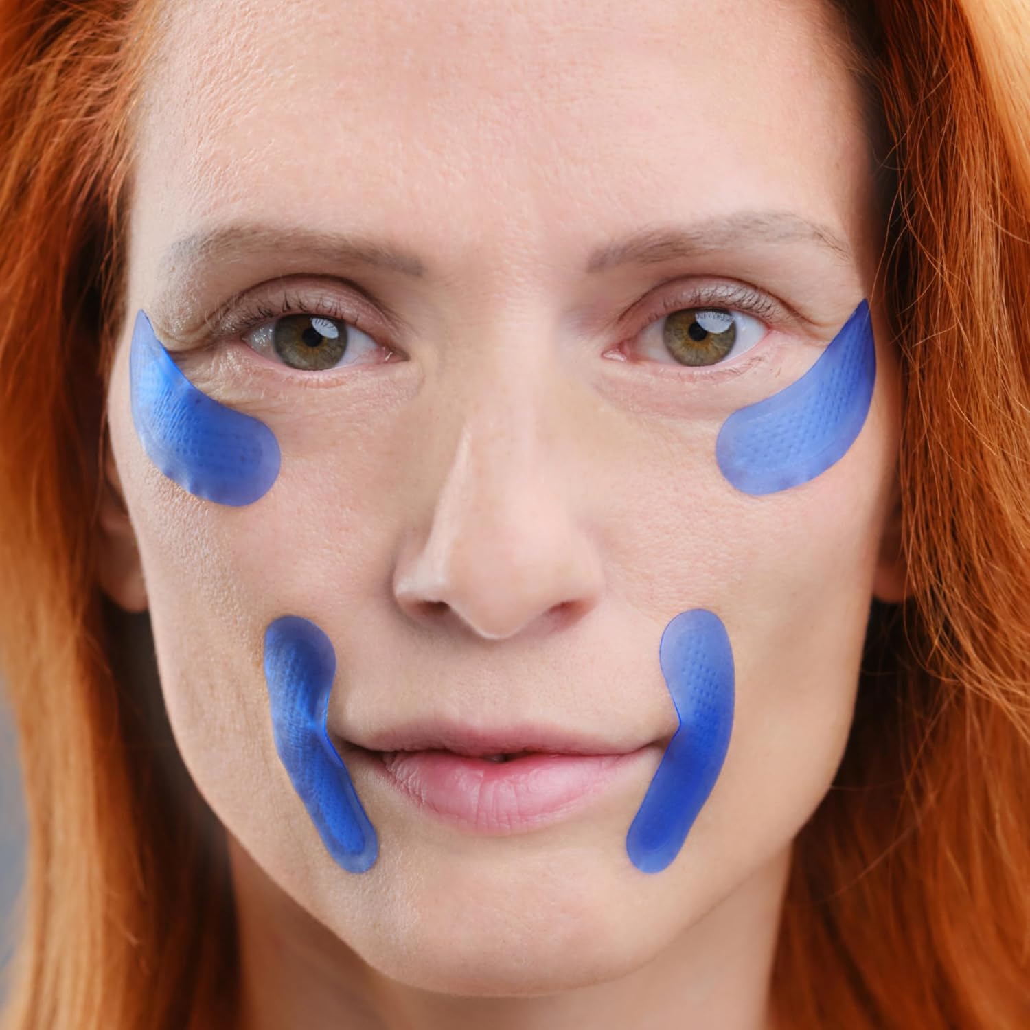 Micro-Infusion anti Wrinkle Patches for Smile Line, Frown Lines, under Eye Bags, Puffiness, Crow'S Feet - Retinol, Caffeine - Dissolvable for Overnight Use - 8 Pairs