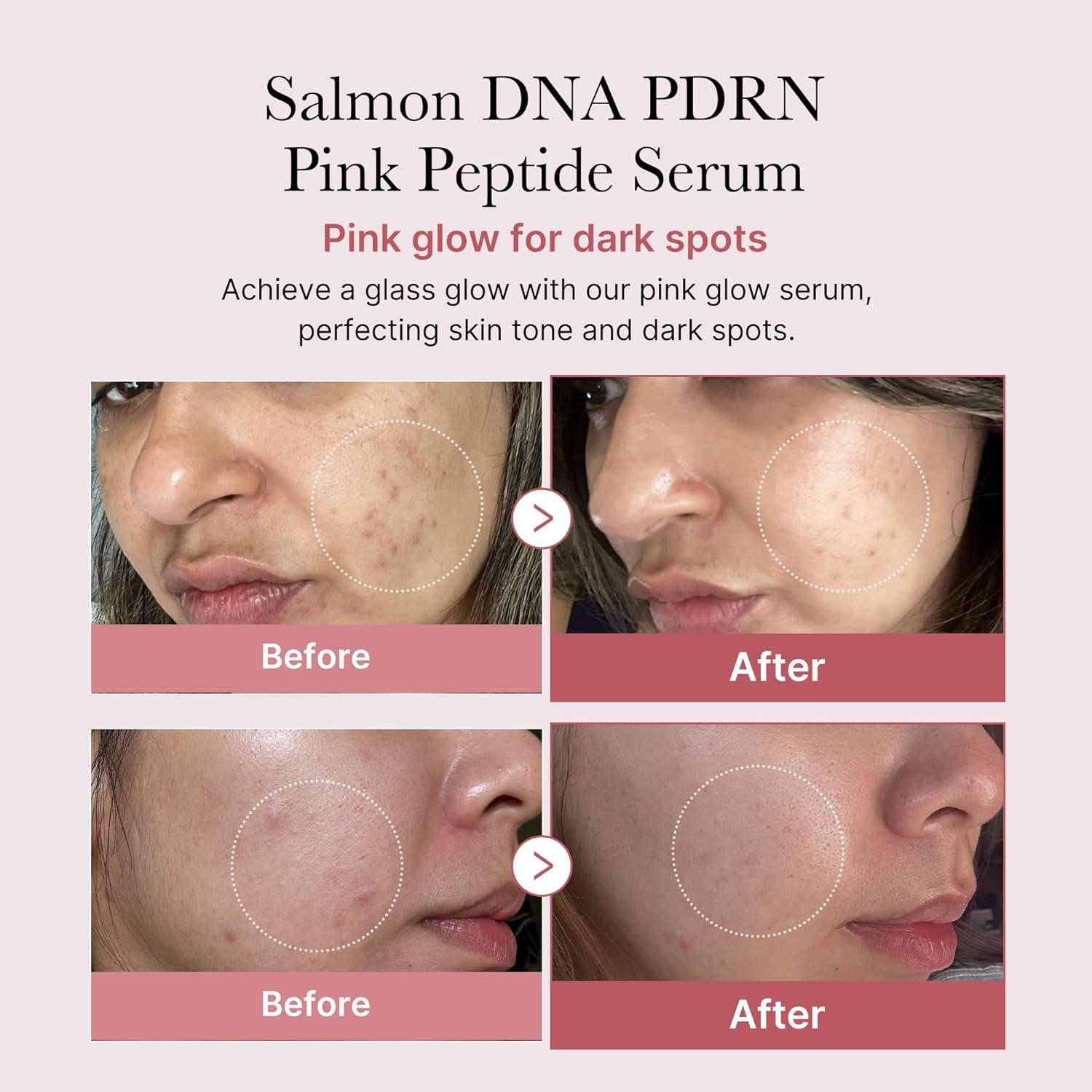 Revitalize Your Skin with Salmon DNA PDRN Pink Peptide Serum - Hydrating, Firming & Brightening for a Glowing Complexion | 1.01 Fl.Oz.